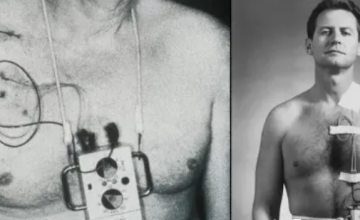 科幻照进现实----便携式心脏起搏器的发明