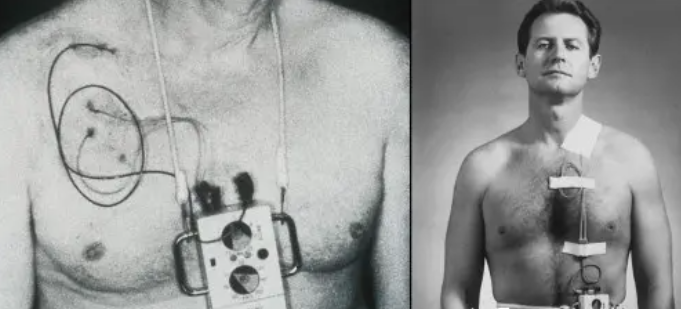 科幻照进现实----便携式心脏起搏器的发明